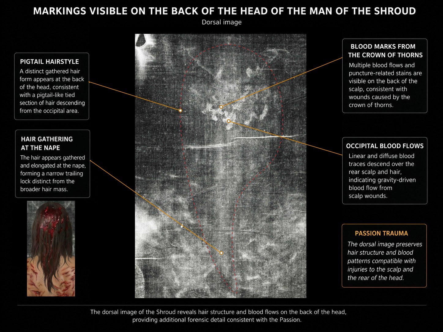 Dorsal image of the head with labelled marks: the hairline and pigtail-like section of hair, a lock of hair gathered at the nape, blood marks from the crown of thorns, and occipital blood flows descending over the scalp.