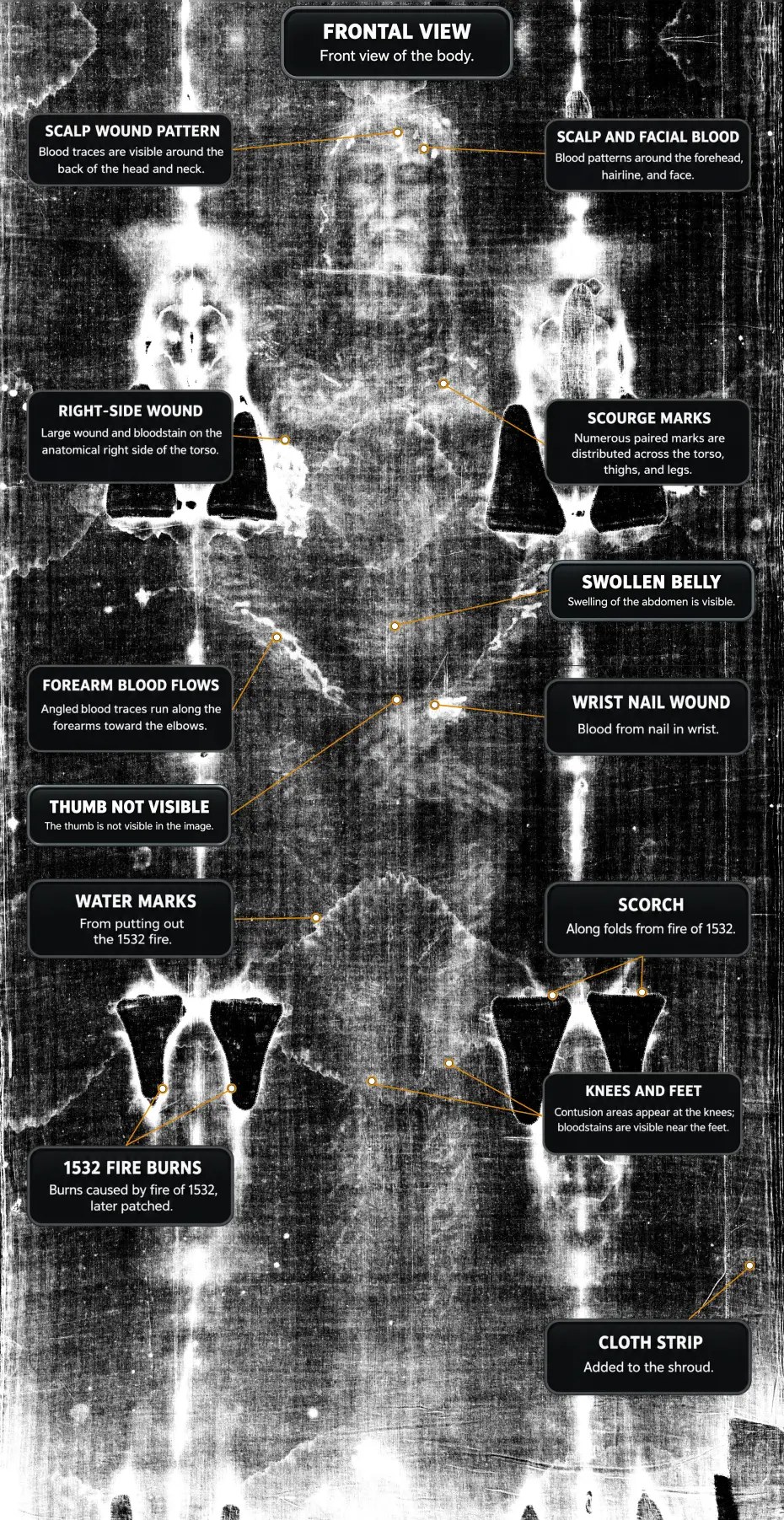 Frontal view of the full negative image with labelled wounds: scalp, right side, forearms, wrist, thumb, scourge marks, 1532 fire burns, water marks, and cloth strip.