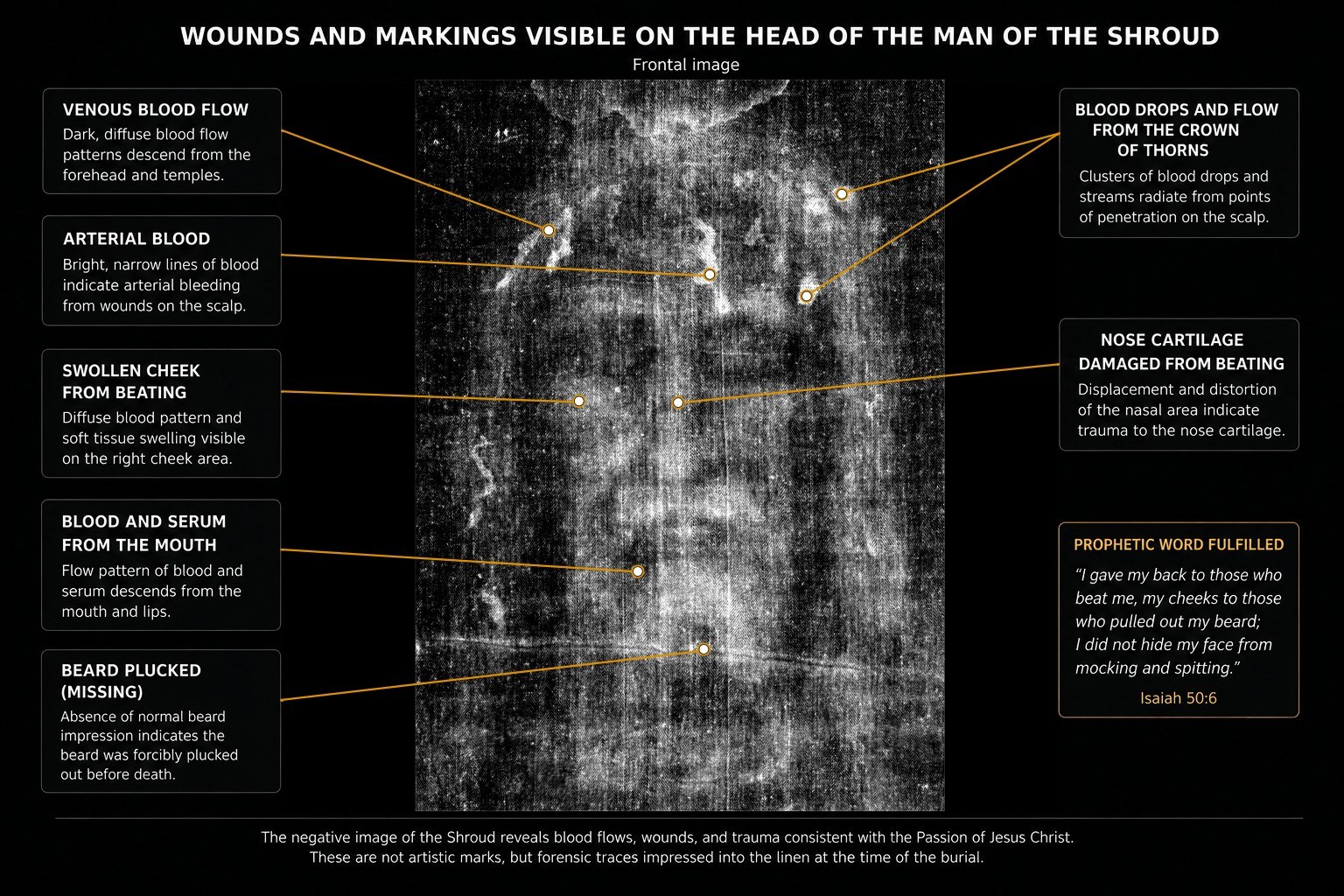 Frontal image of the head with labelled marks: venous and arterial blood flows, blood from the crown of thorns, swelling on the cheek, blood and serum from the mouth, and a beard area labelled as plucked.